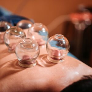 Cupping Massage
